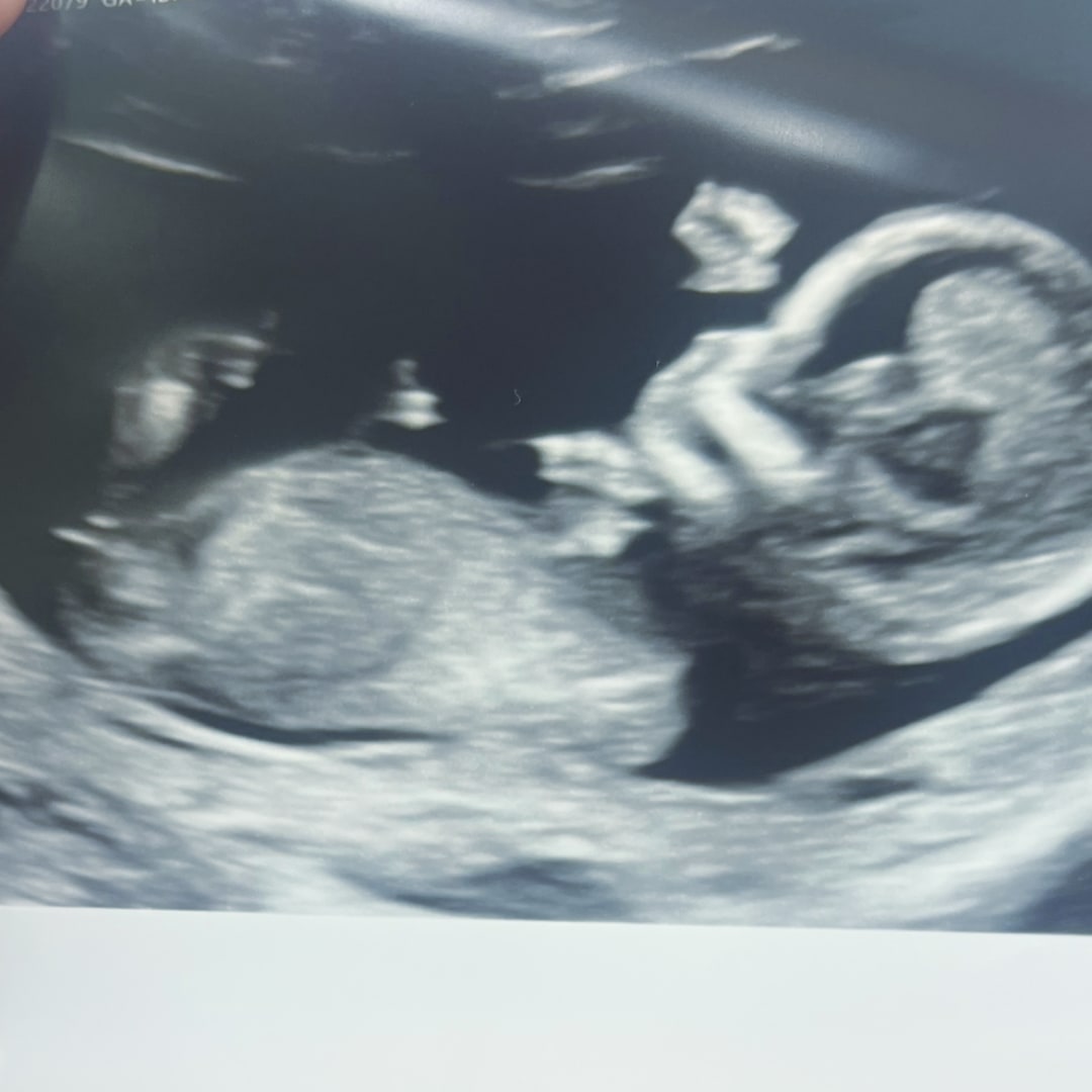 Photo shared by Allison for their Babylist baby registry.