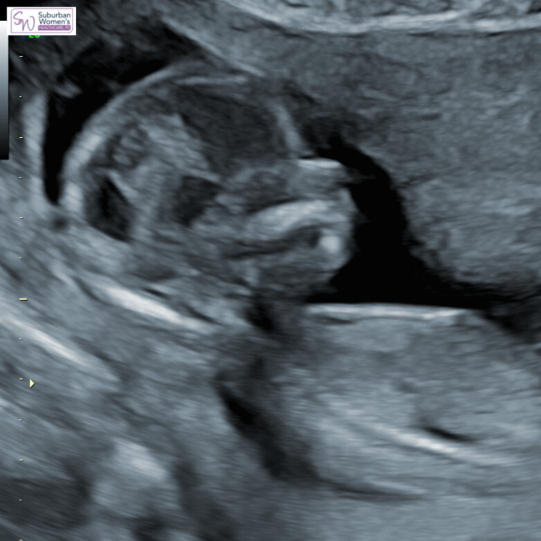 Photo shared by Jillian for their Babylist baby registry.