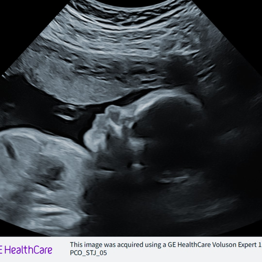 Photo shared by Annie for their Babylist baby registry.