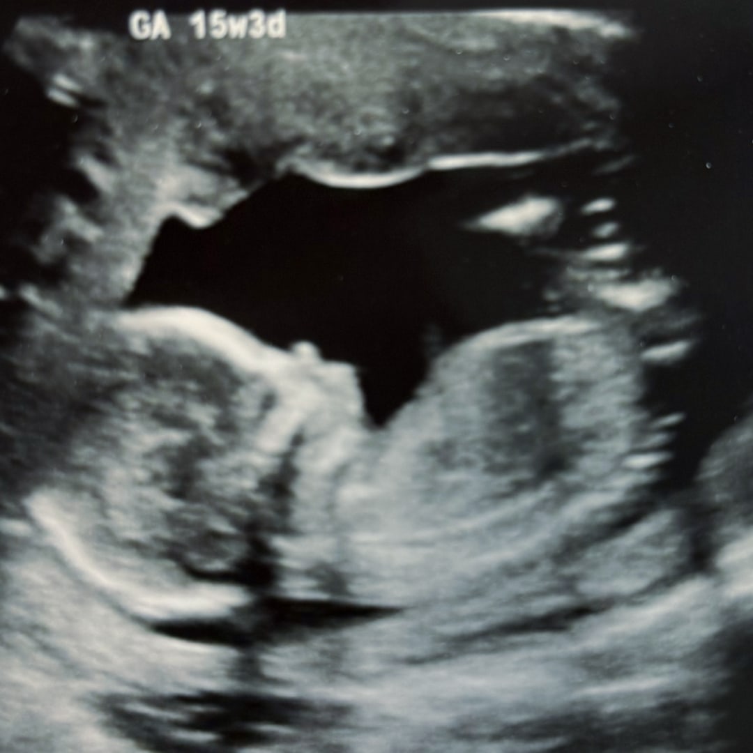 Photo shared by Natalia for their Babylist baby registry.