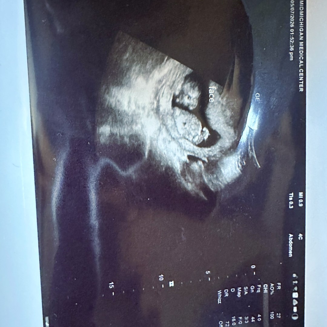Photo shared by Georgina for their Babylist baby registry.