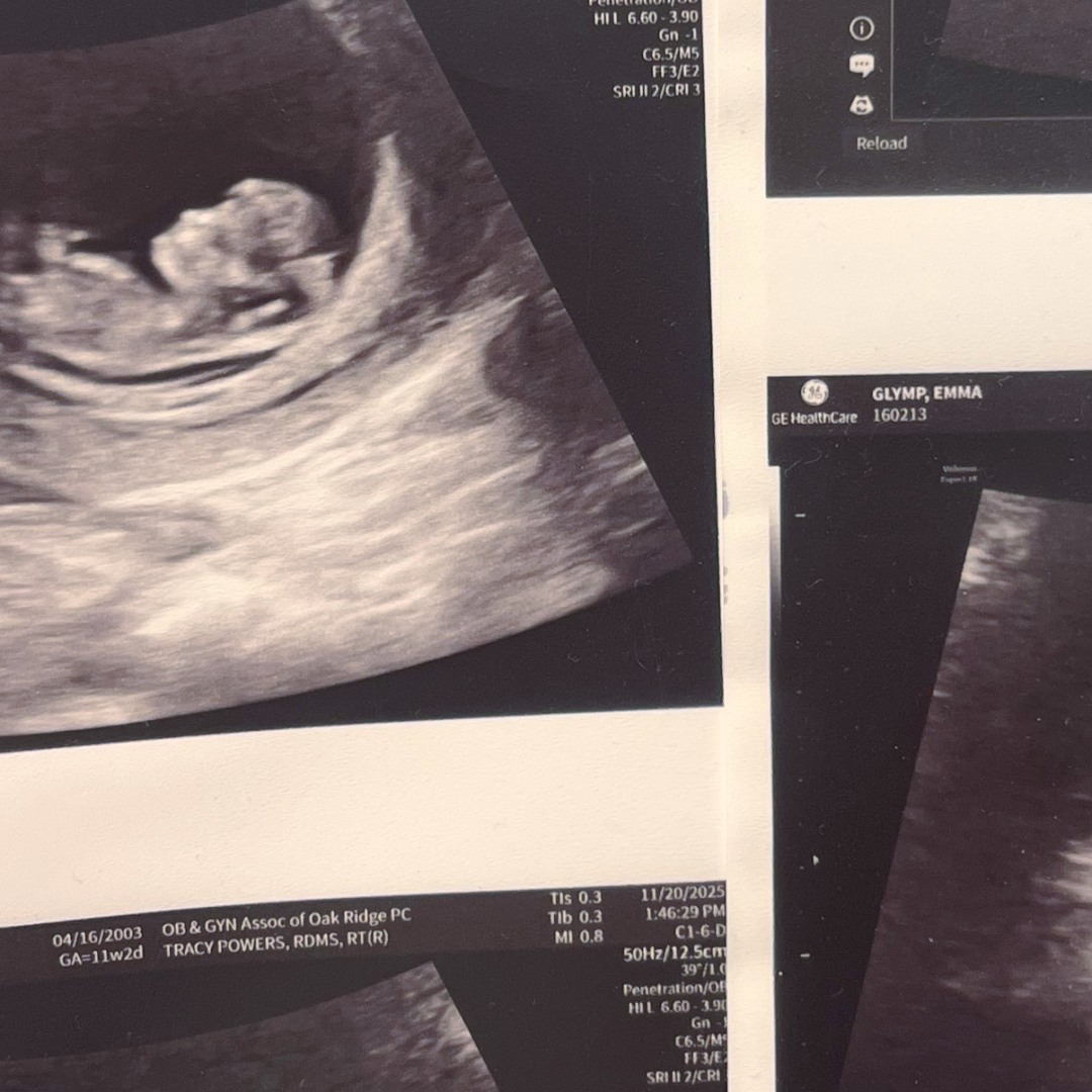 Photo shared by Emma for their Babylist baby registry.