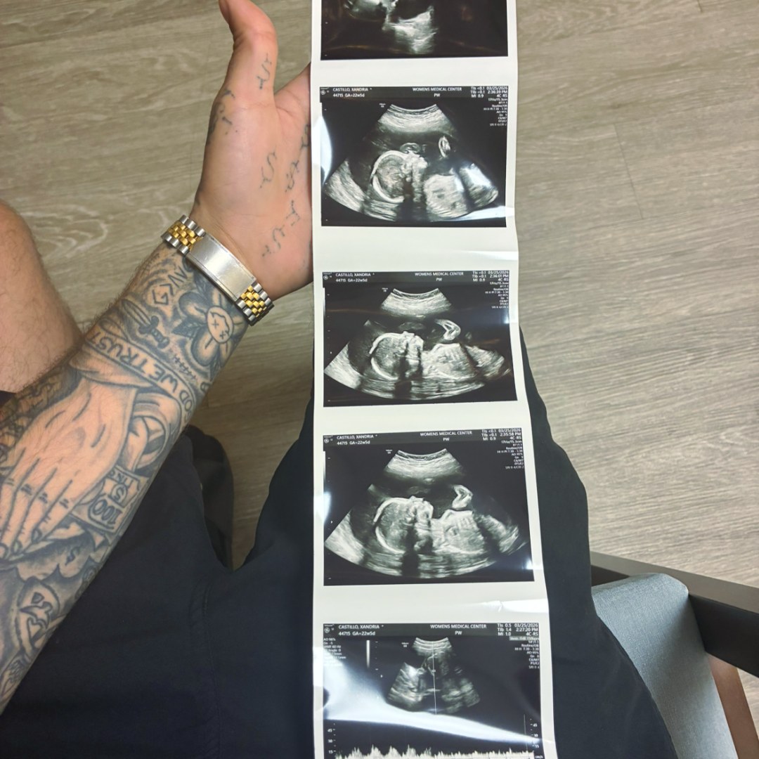 Photo shared by Xandria for their Babylist baby registry.