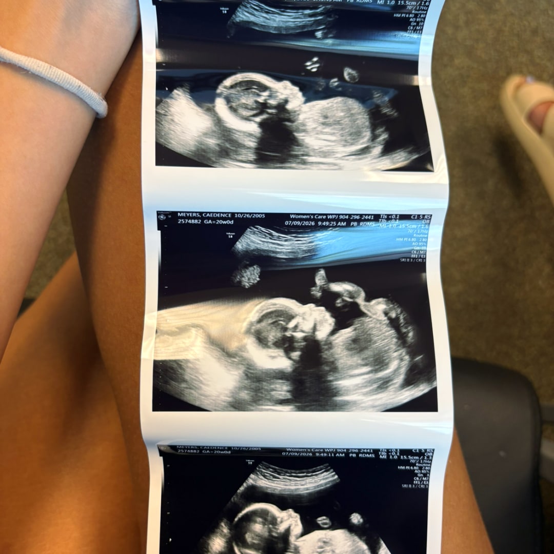 Photo shared by Caedence for their Babylist baby registry.
