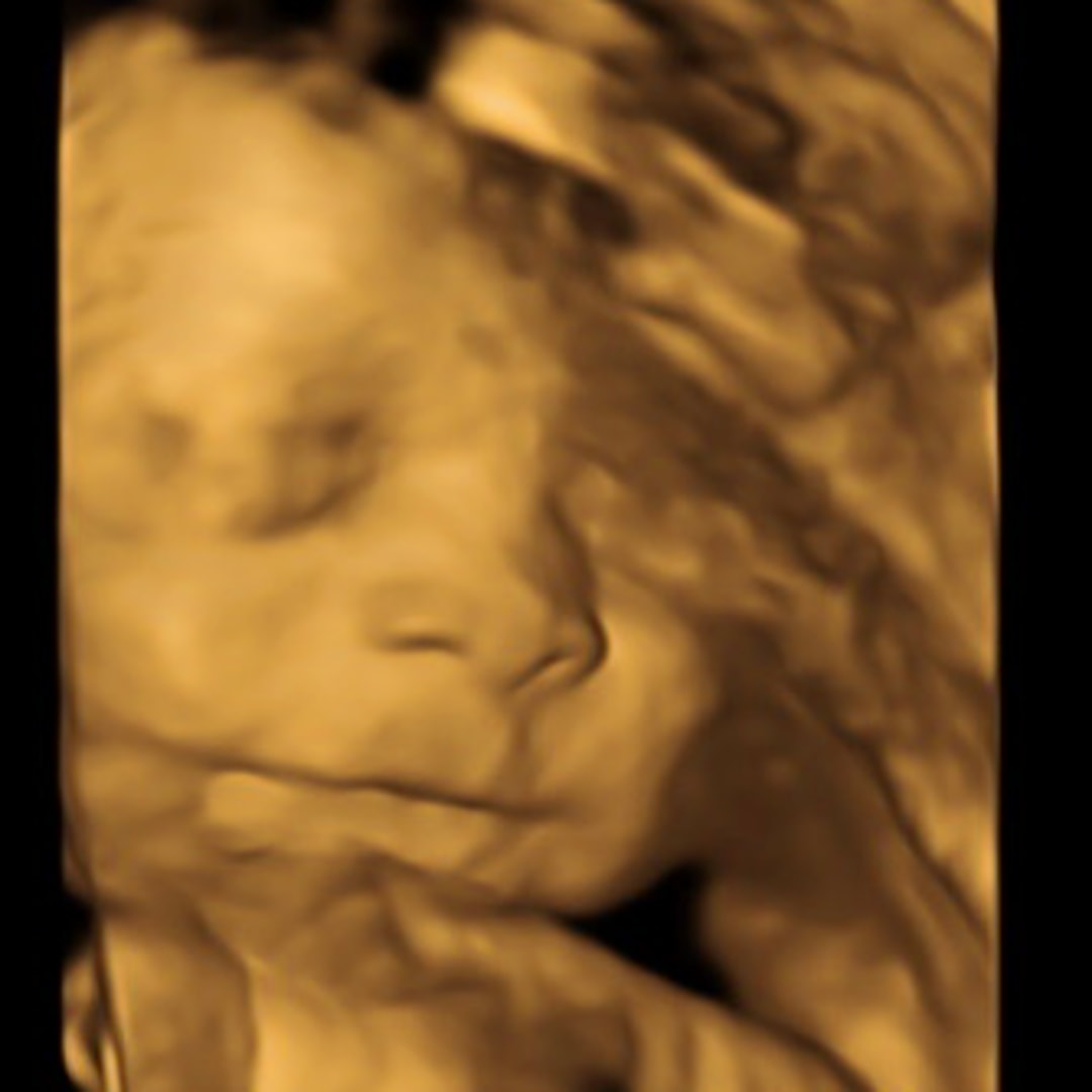 Photo shared by Victoria for their Babylist baby registry.