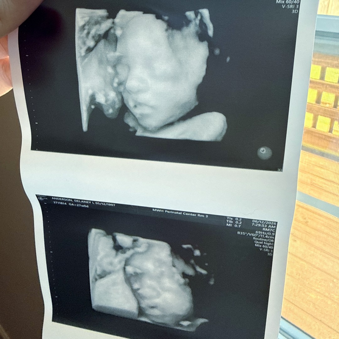 Photo shared by Delaney for their Babylist baby registry.