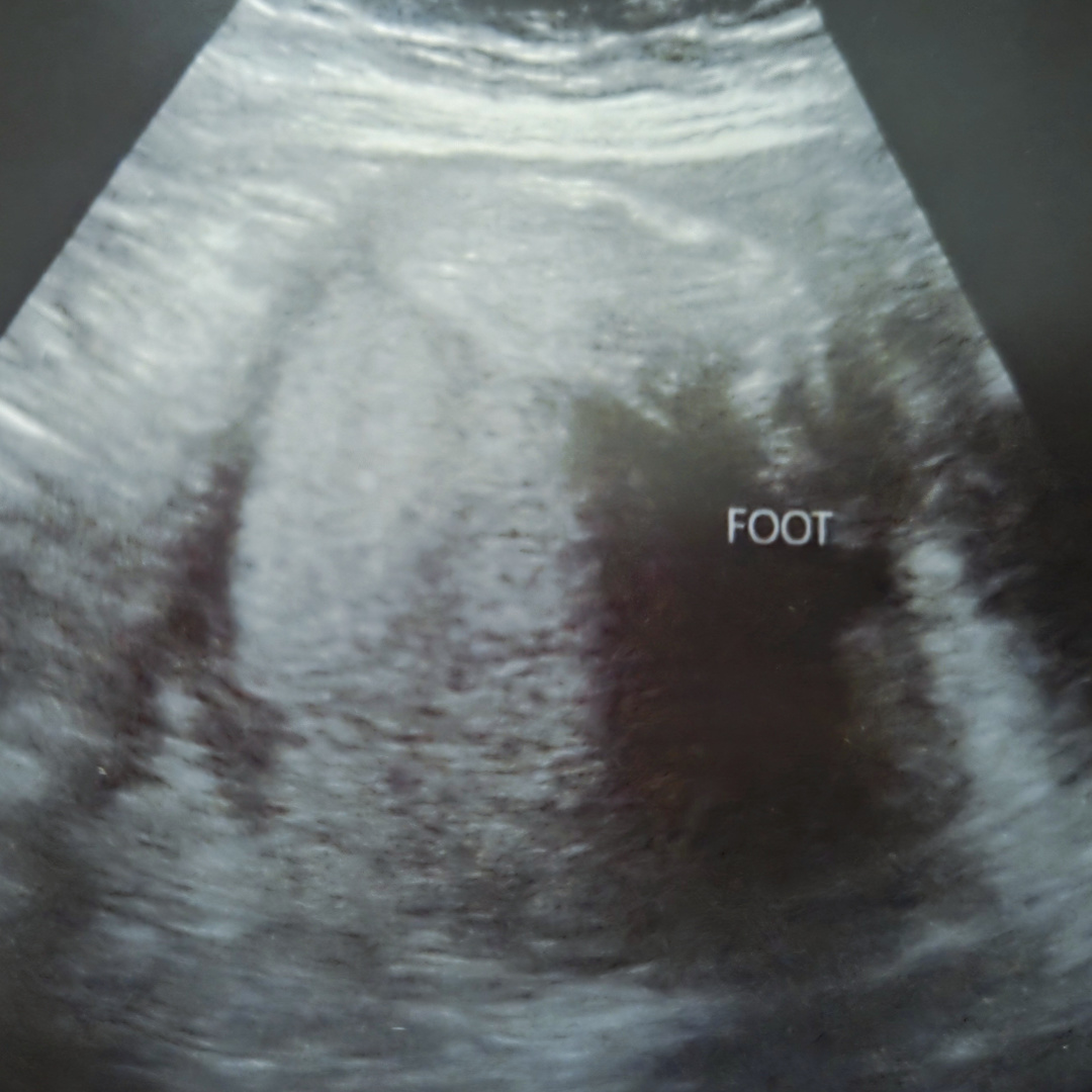 Photo shared by Ashley for their Babylist baby registry.