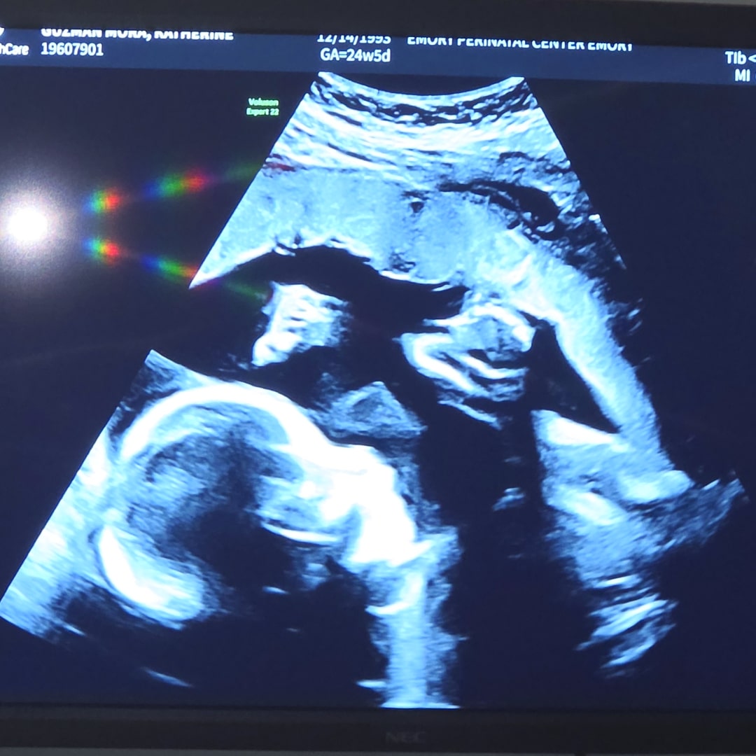 Photo shared by Katherine for their Babylist baby registry.