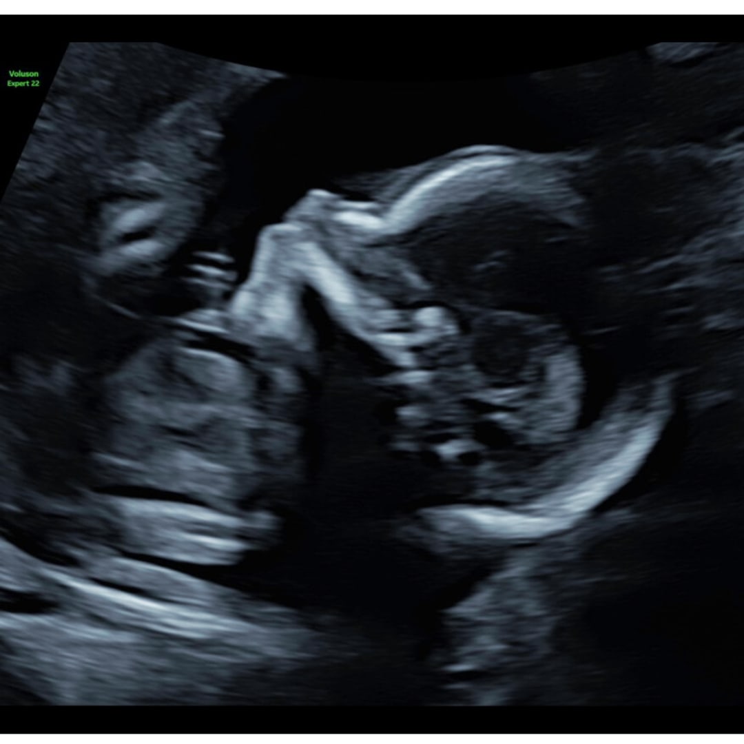 Photo shared by Sam for their Babylist baby registry.
