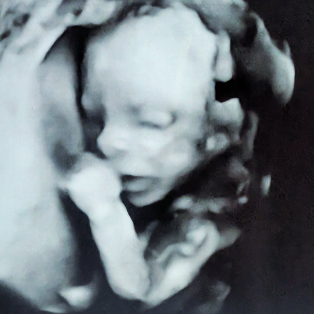 Photo shared by Shelby for their Babylist baby registry.