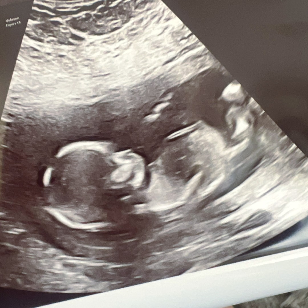 Photo shared by Colby for their Babylist baby registry.