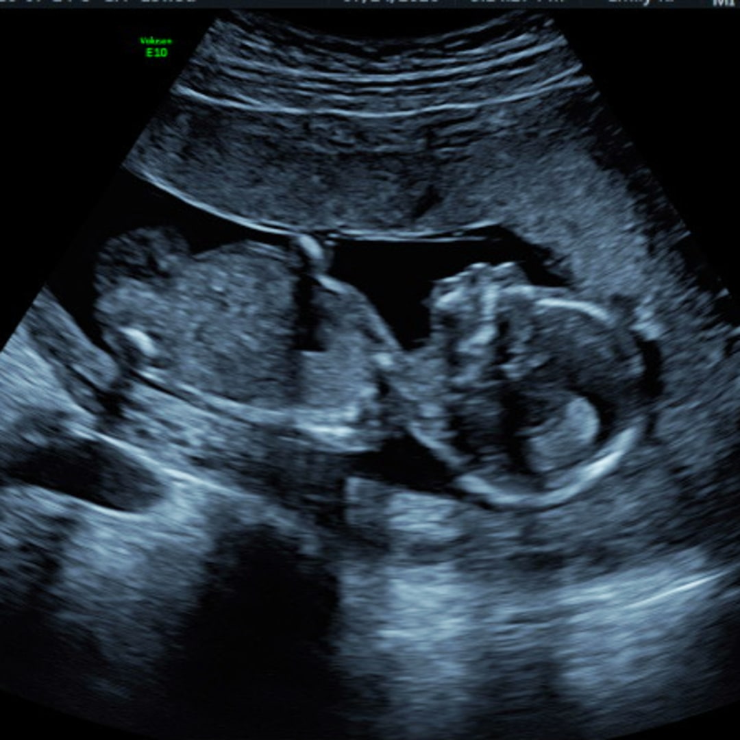 Photo shared by Nakisha for their Babylist baby registry.