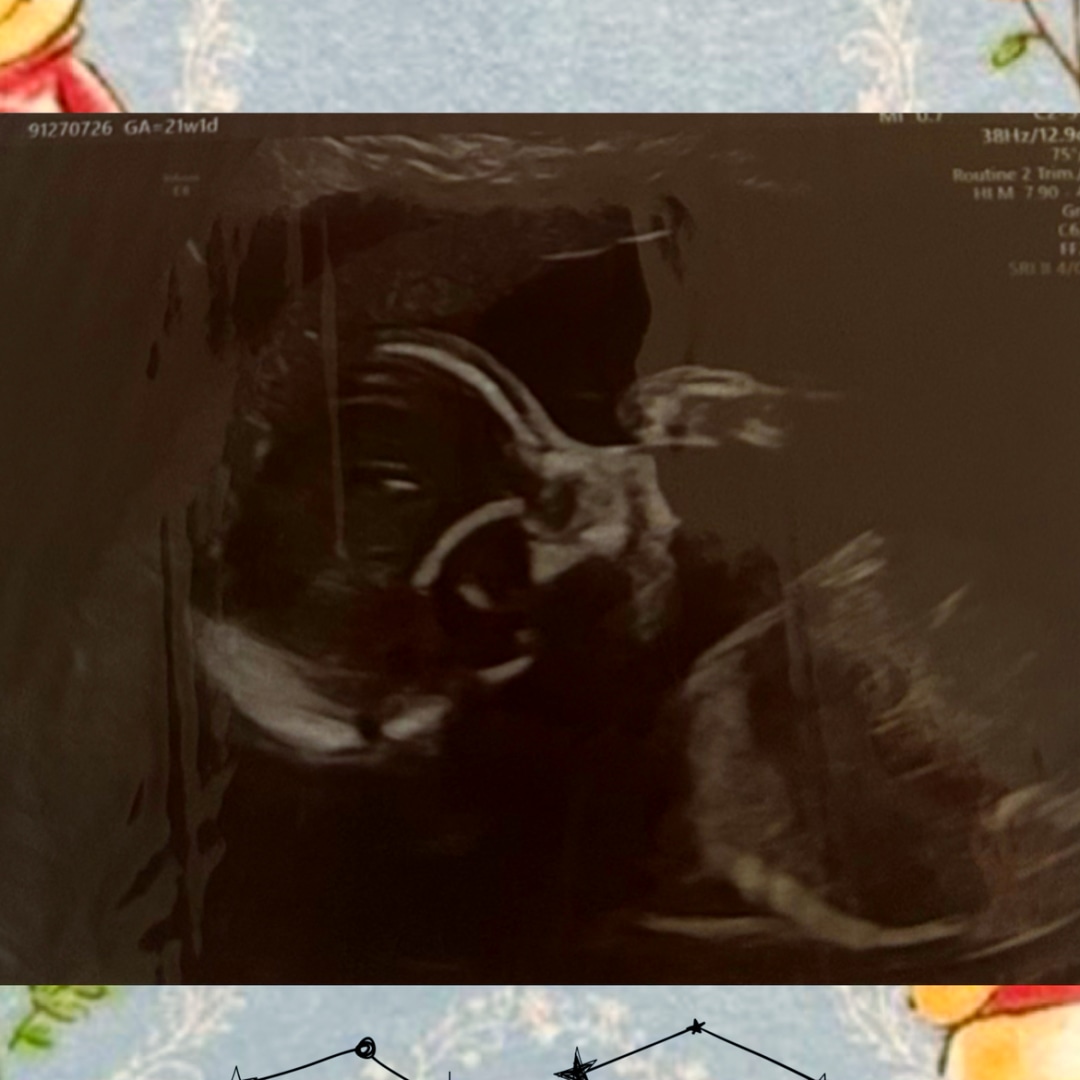 Photo shared by Akire for their Babylist baby registry.