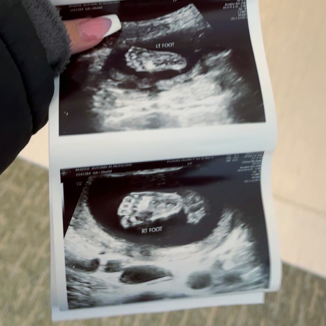 Photo shared by Autumn for their Babylist baby registry.