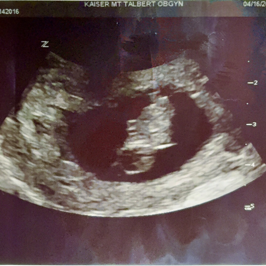 Photo shared by Kaylee for their Babylist baby registry.