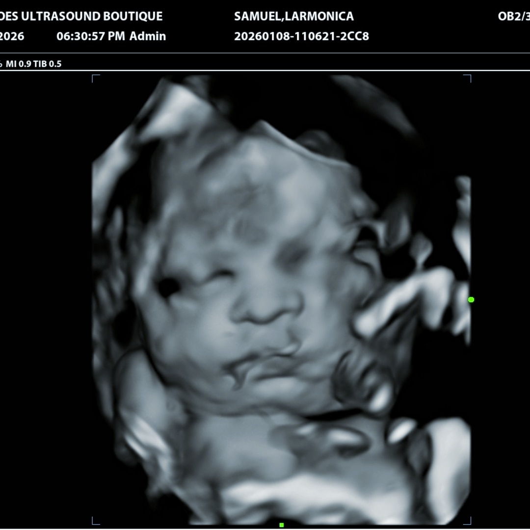 Photo shared by Larmonica for their Babylist baby registry.