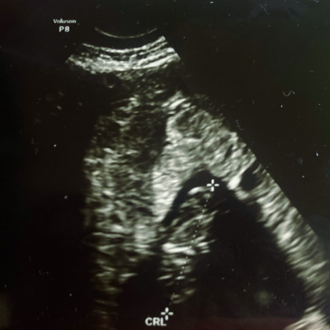 Photo shared by Nuvia for their Babylist baby registry.