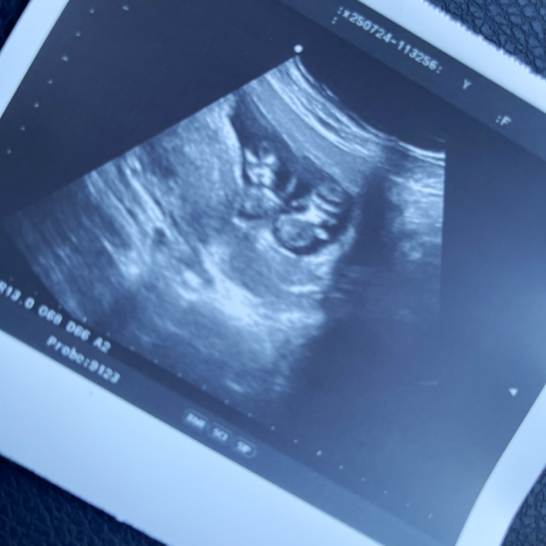 Photo shared by Karina for their Babylist baby registry.