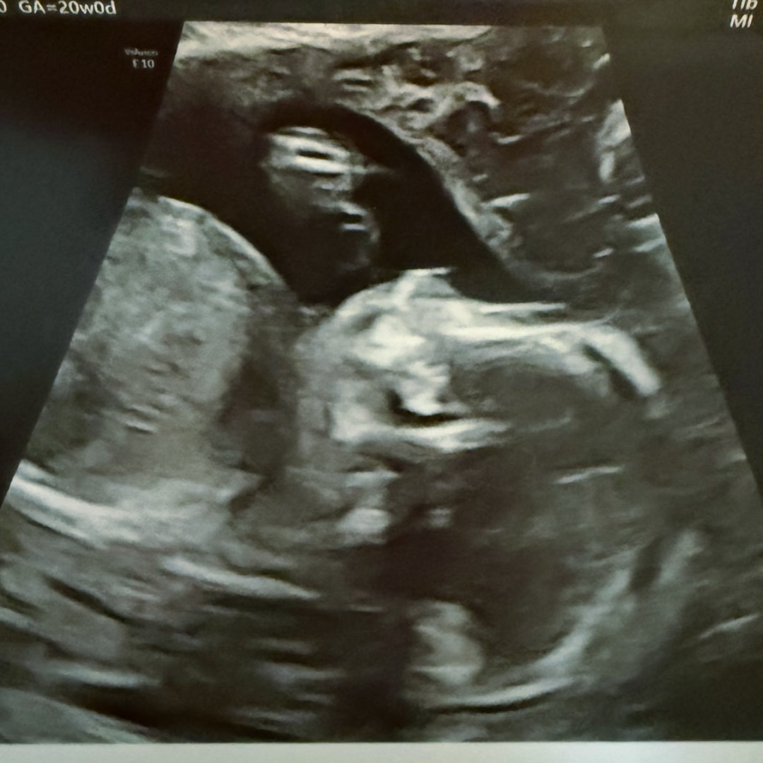 Photo shared by Caroline for their Babylist baby registry.
