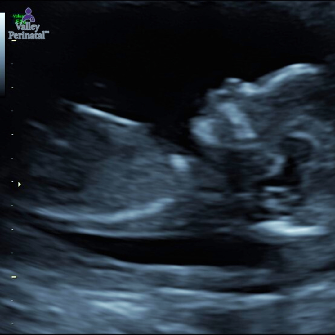 Photo shared by Lenae for their Babylist baby registry.