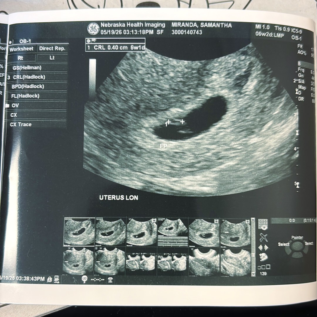 Photo shared by Samantha for their Babylist baby registry.