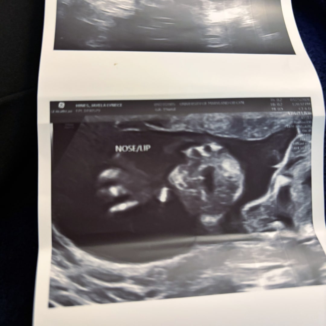 Photo shared by Jayela for their Babylist baby registry.