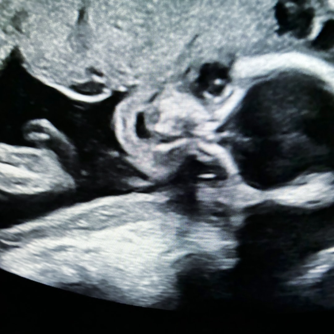 Photo shared by Cinnamon for their Babylist baby registry.