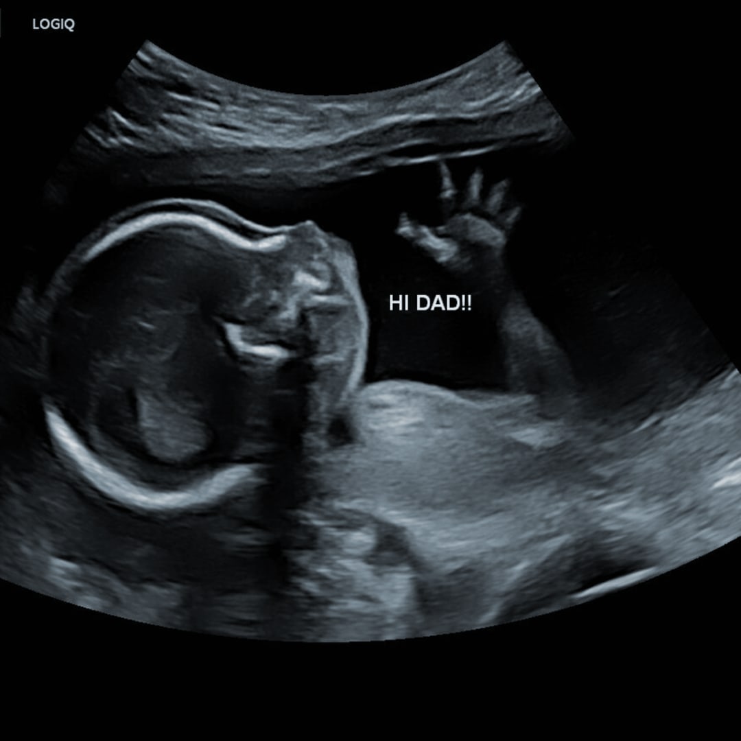 Photo shared by Georgina for their Babylist baby registry.