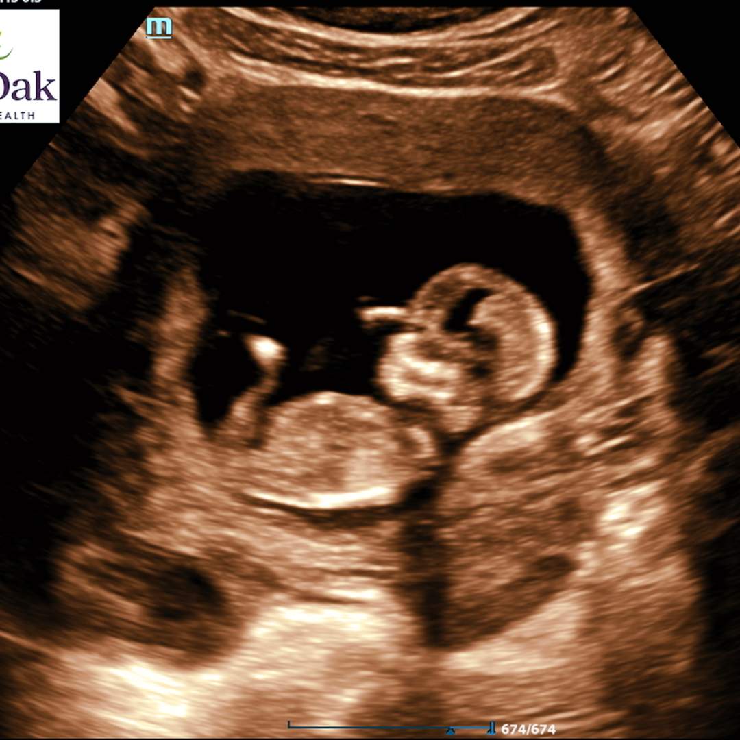 Photo shared by Ash for their Babylist baby registry.