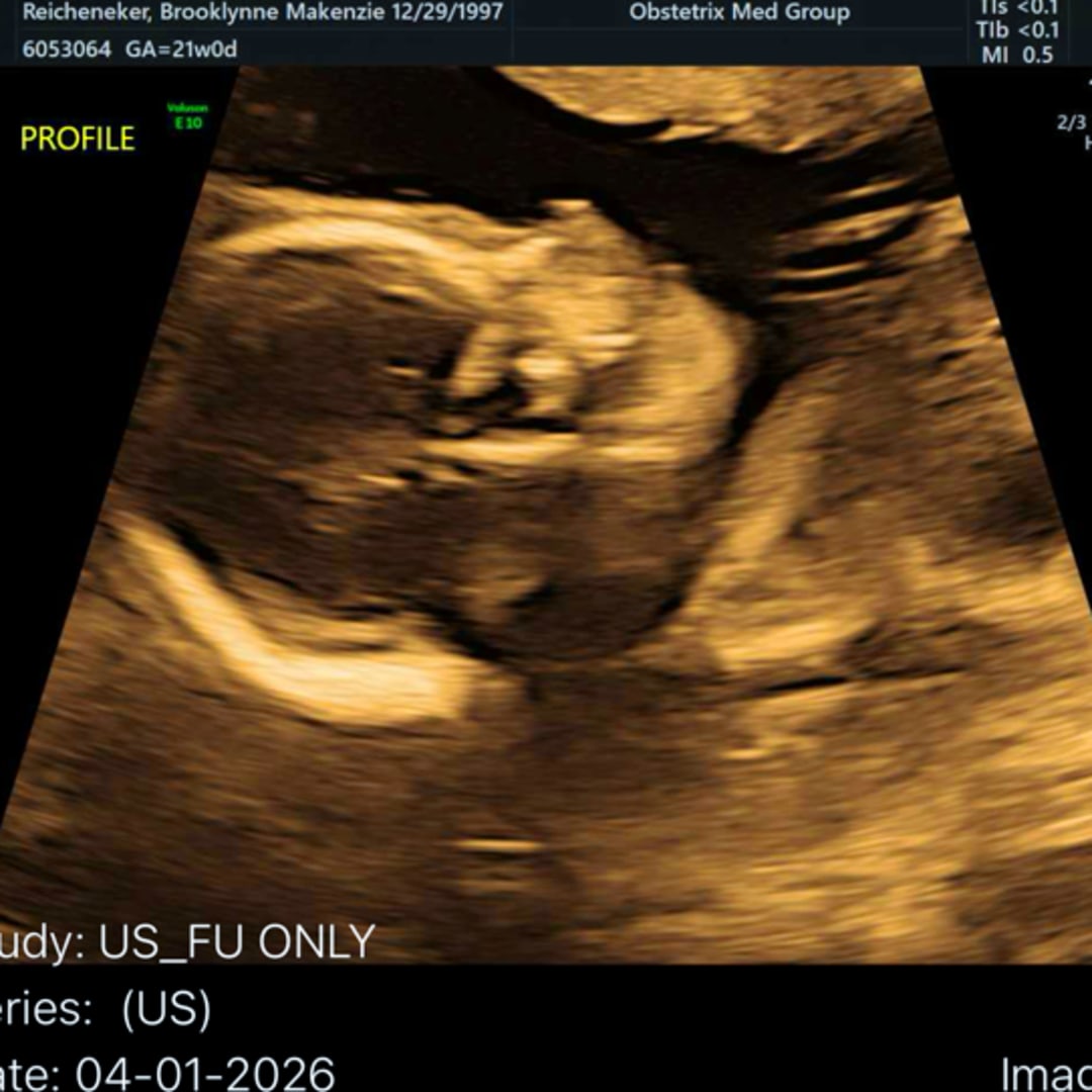 Photo shared by Brooklynne for their Babylist baby registry.