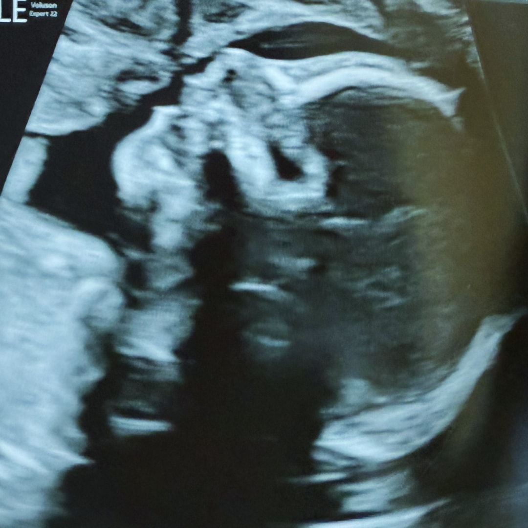 Photo shared by Kristina for their Babylist baby registry.