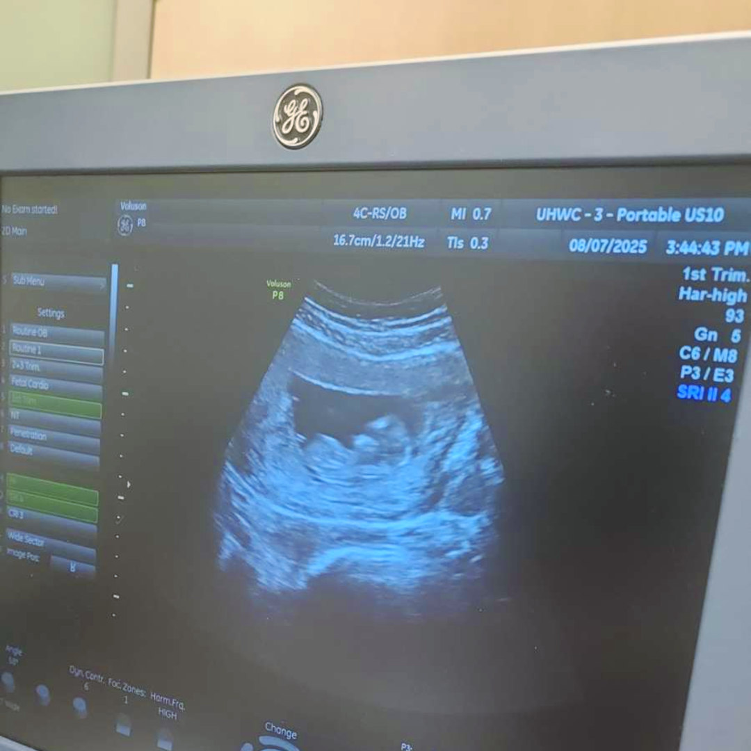 Photo shared by Lynda for their Babylist baby registry.