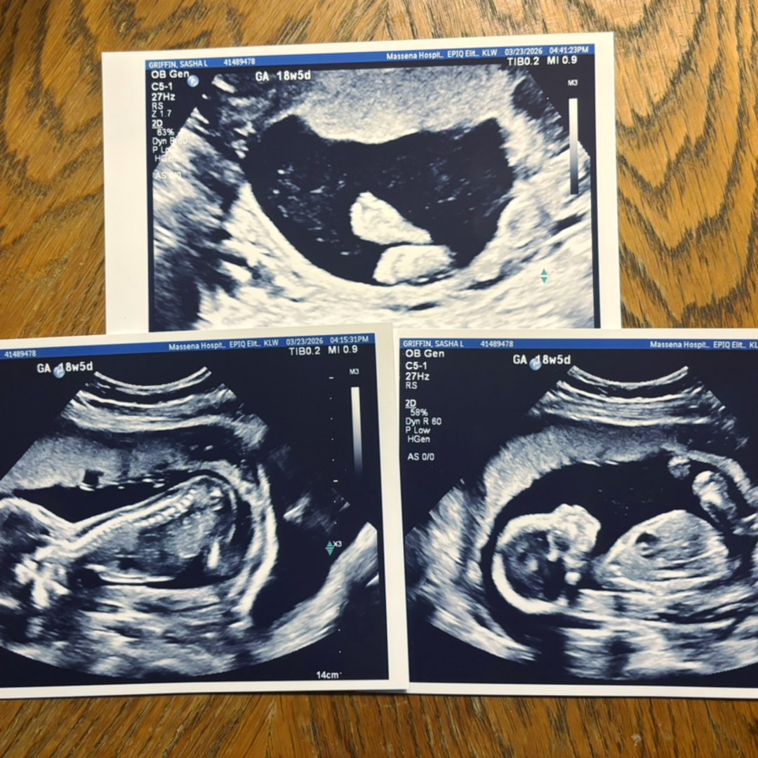 Photo shared by Sasha for their Babylist baby registry.