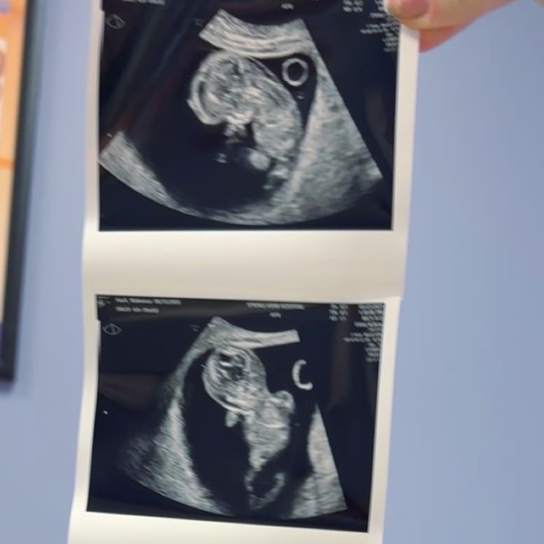 Photo shared by Kenna for their Babylist baby registry.