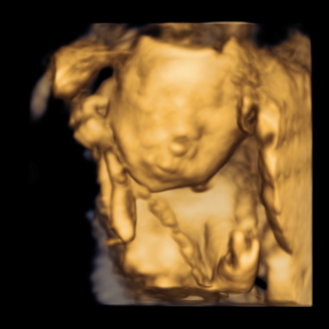 Photo shared by Mali’e for their Babylist baby registry.