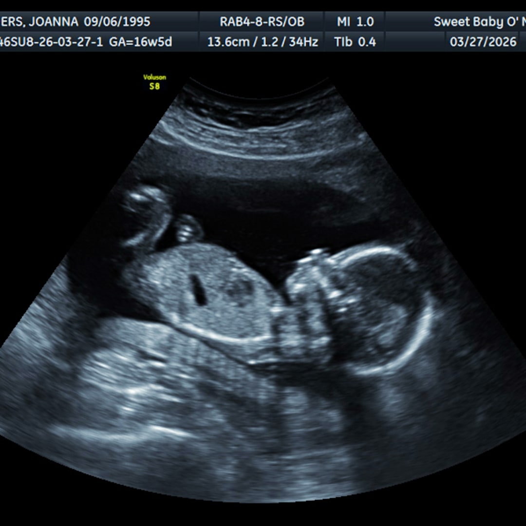 Photo shared by Joanna for their Babylist baby registry.