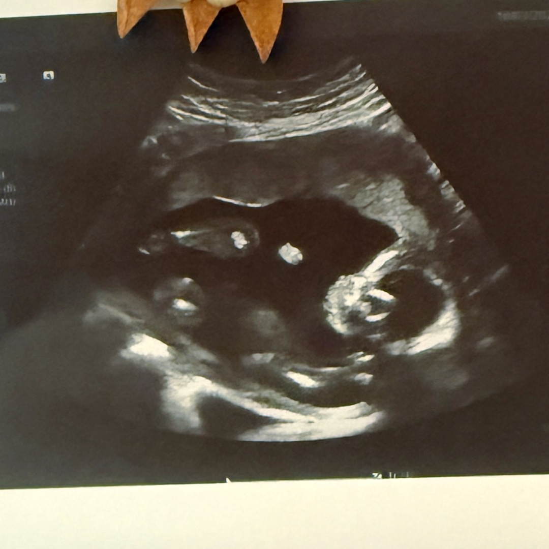 Photo shared by Cora for their Babylist baby registry.