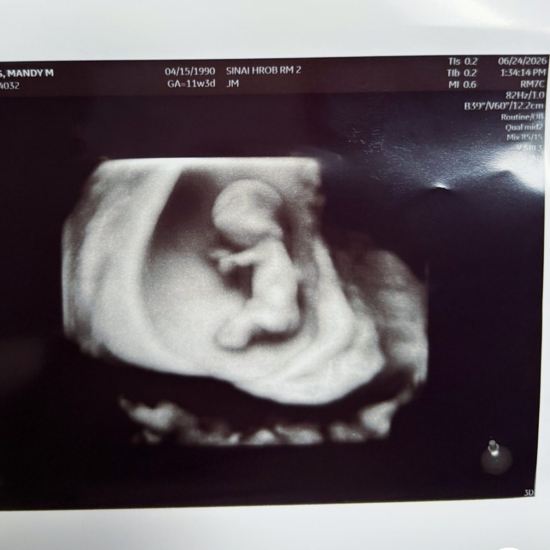Photo shared by Mandy for their Babylist baby registry.