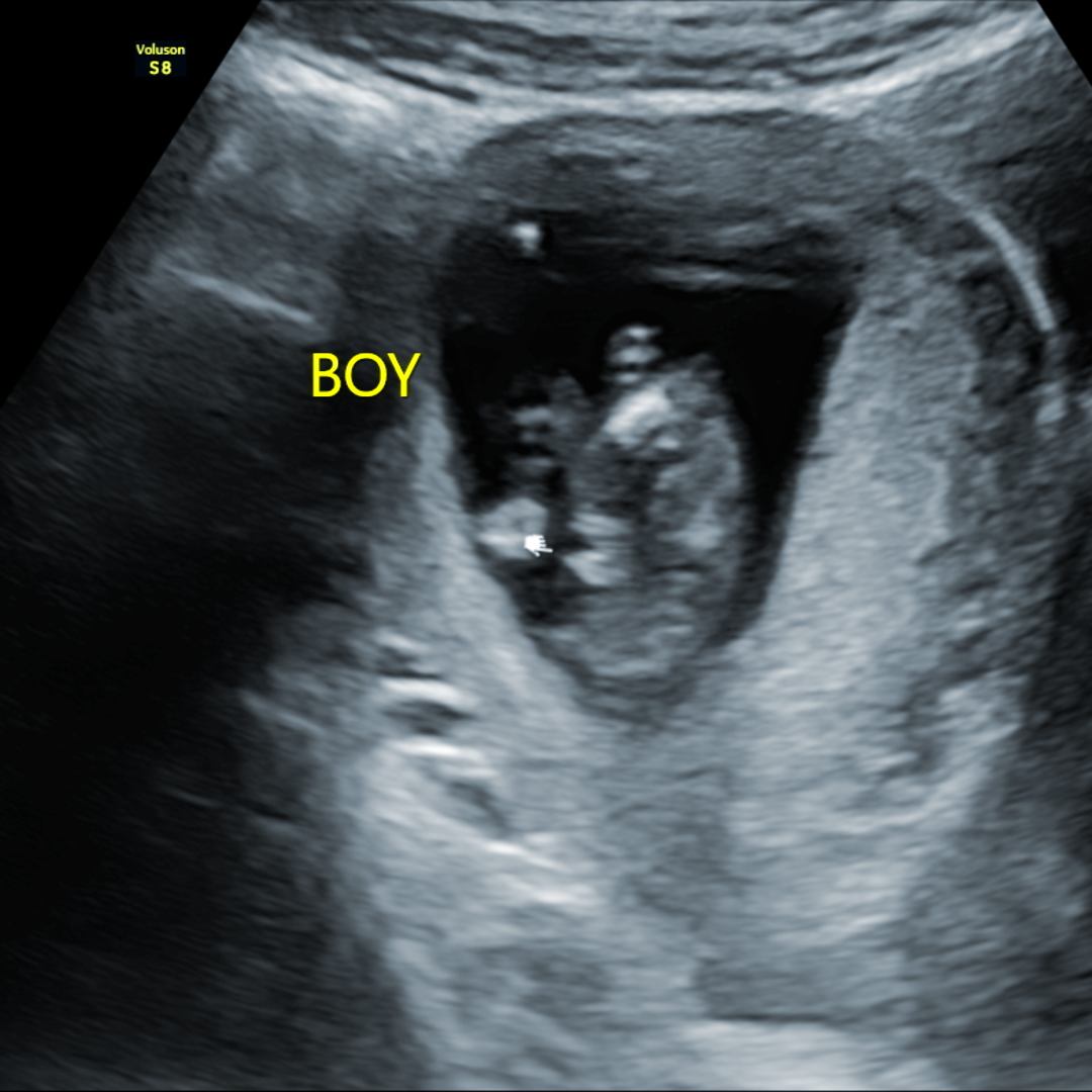 Photo shared by Abby for their Babylist baby registry.
