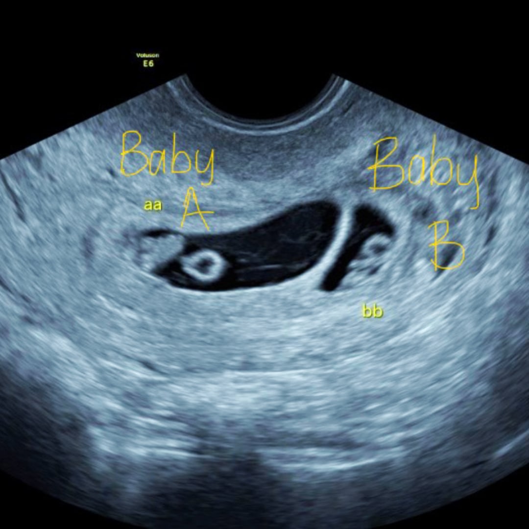 Photo shared by Devon for their Babylist baby registry.