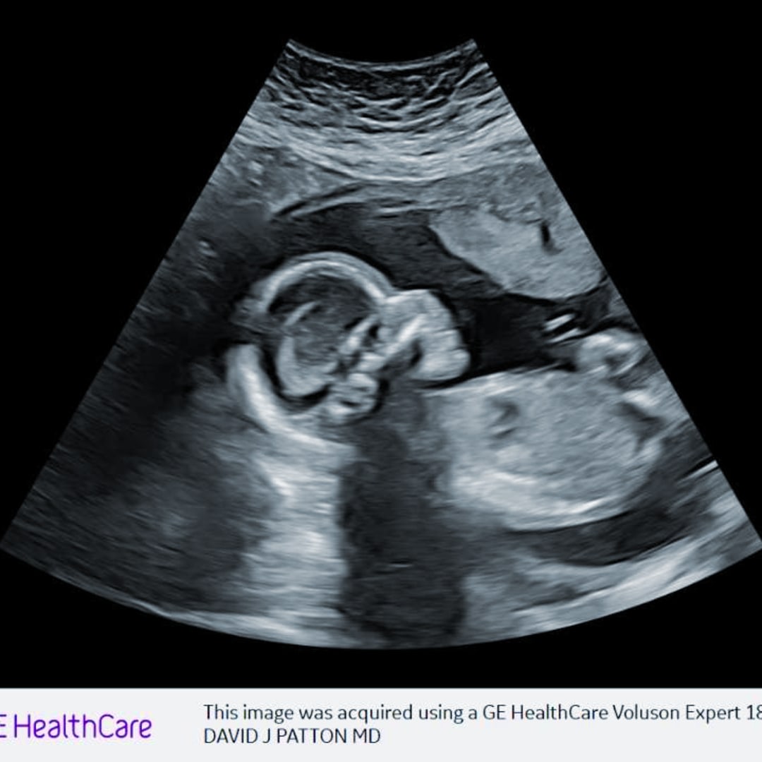 Photo shared by Britani for their Babylist baby registry.