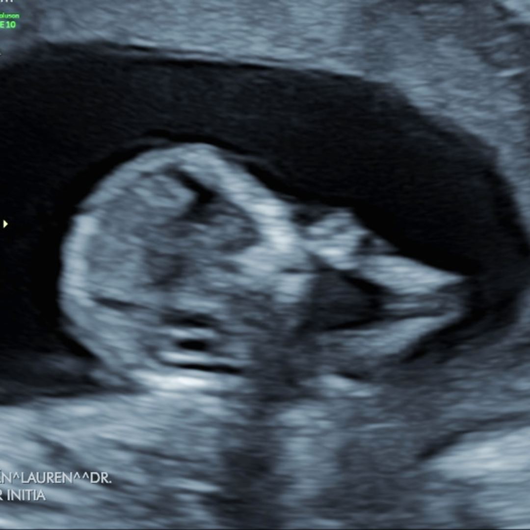 Photo shared by Katherine & Jacob for their Babylist baby registry.