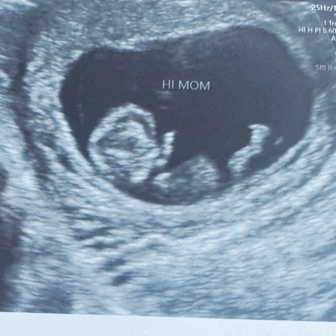 Photo shared by Jayla for their Babylist baby registry.