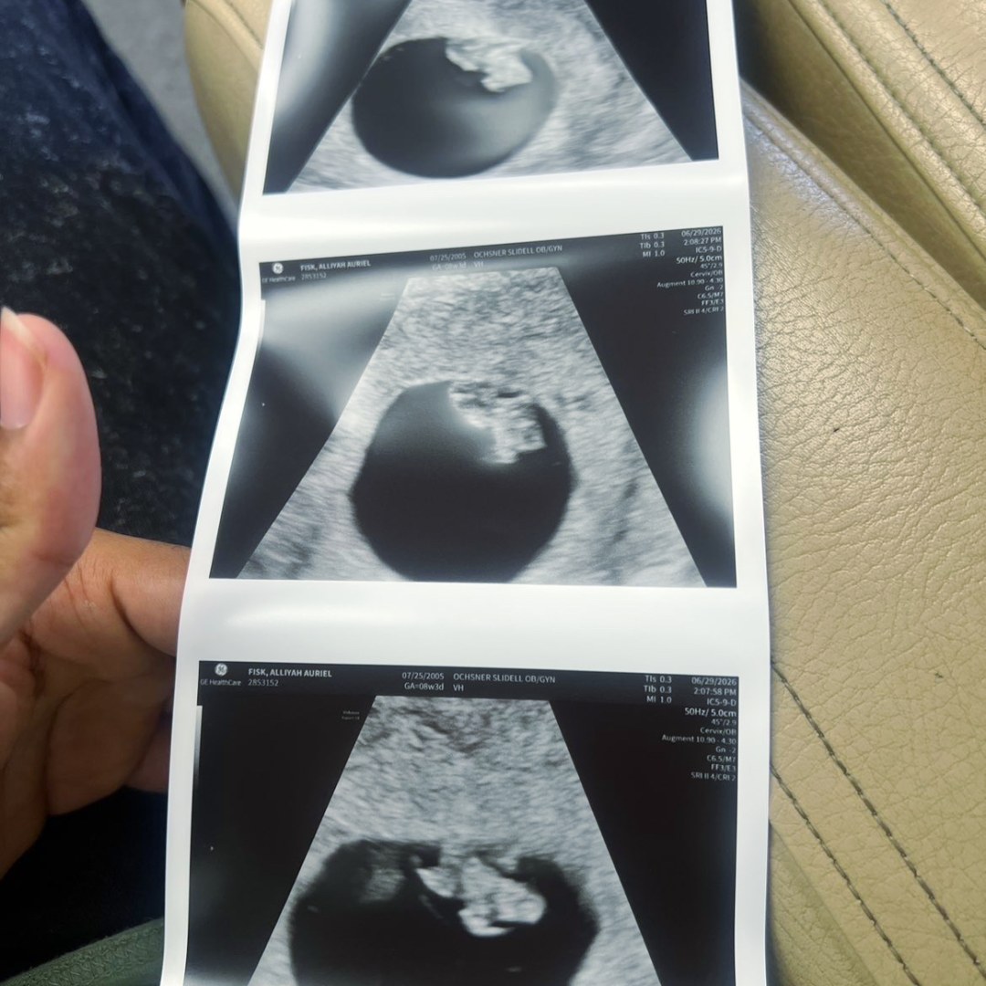 Photo shared by Alliyah for their Babylist baby registry.