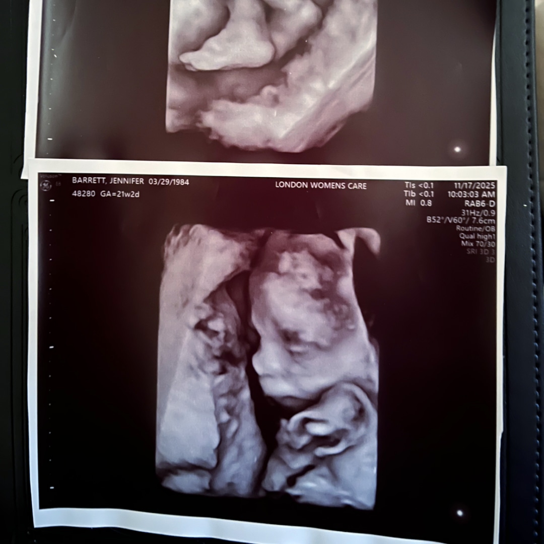 Photo shared by Jennifer for their Babylist baby registry.