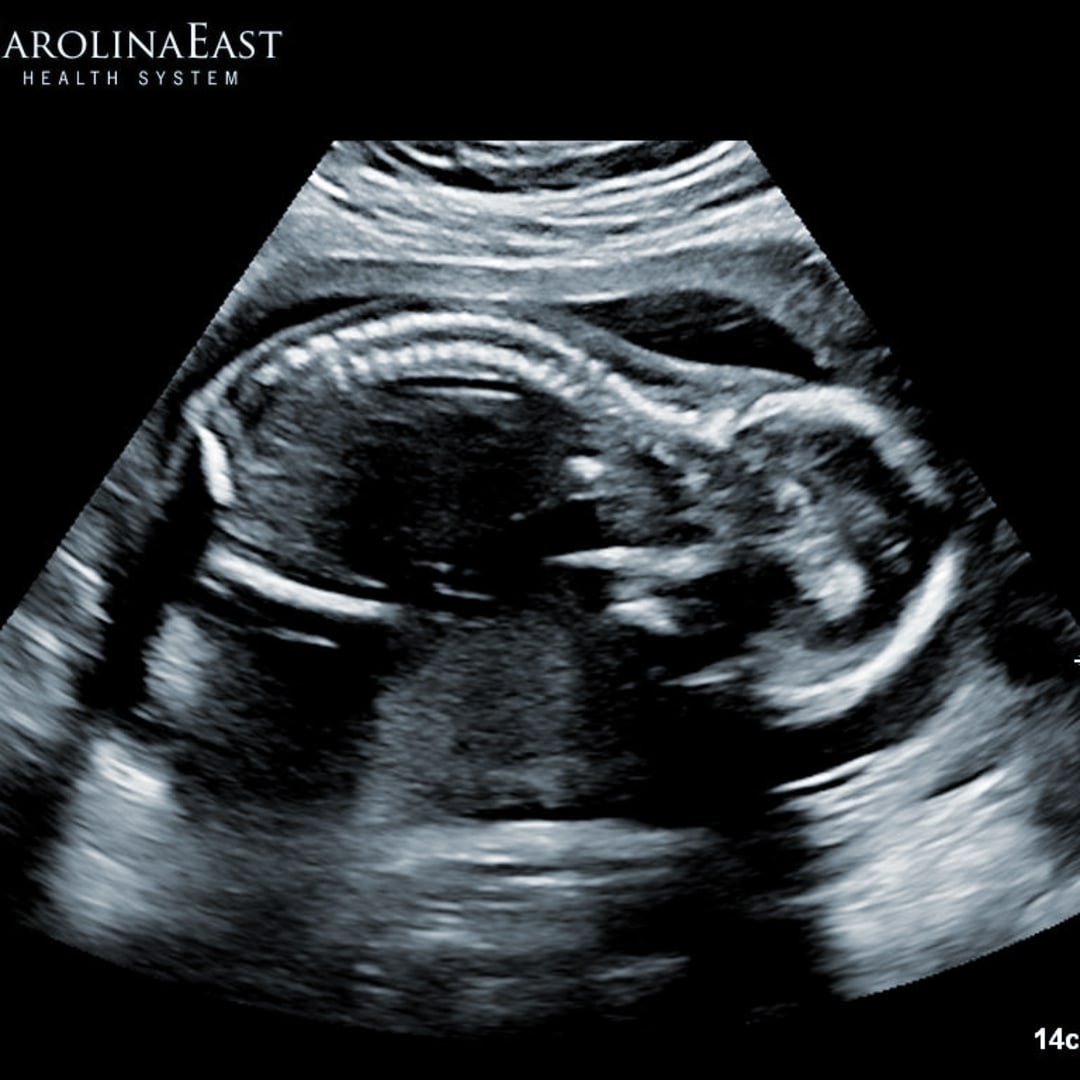 Photo shared by Tiffany for their Babylist baby registry.