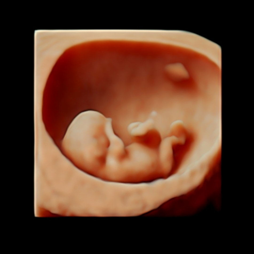 Photo shared by Kayla for their Babylist baby registry.