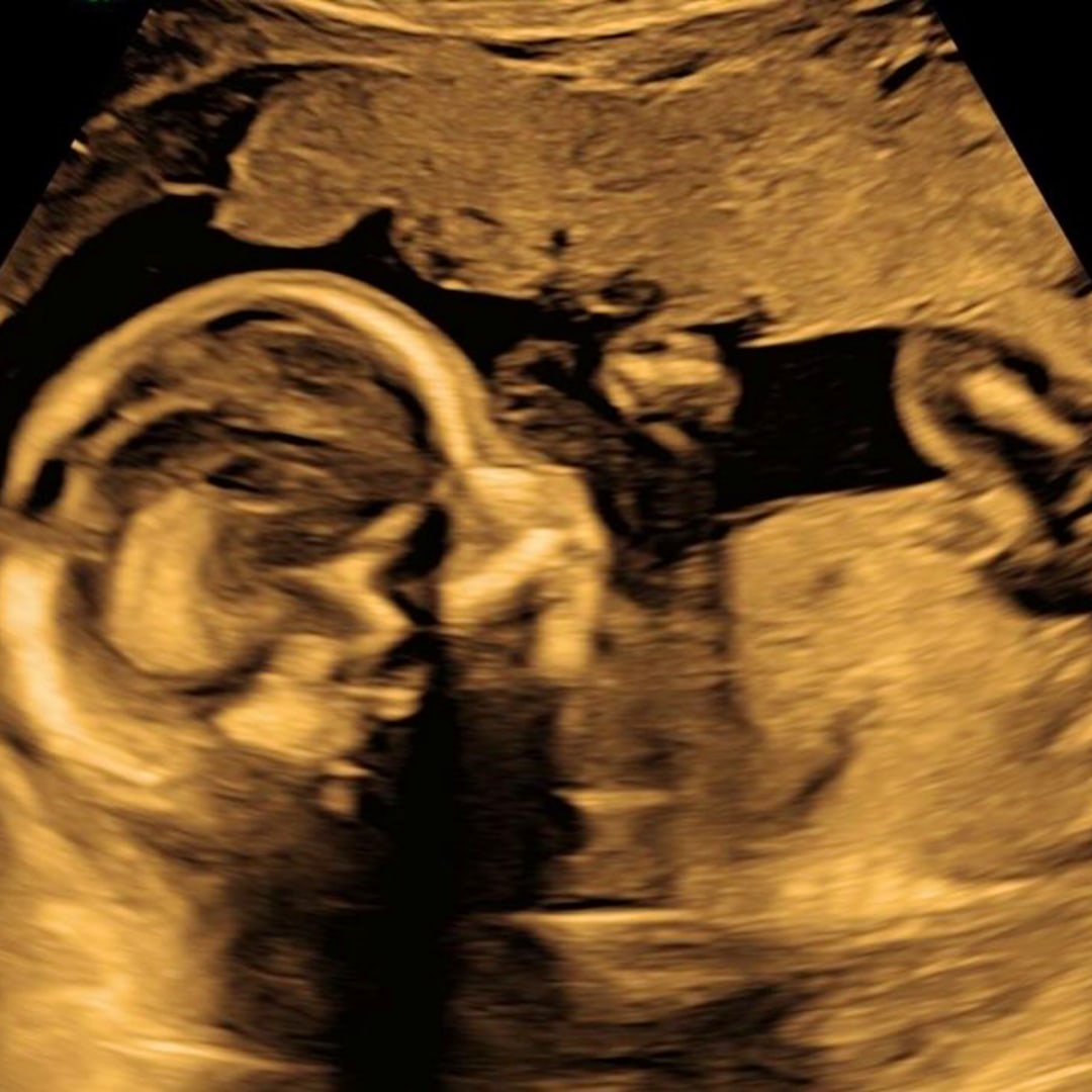 Photo shared by Kimberly for their Babylist baby registry.