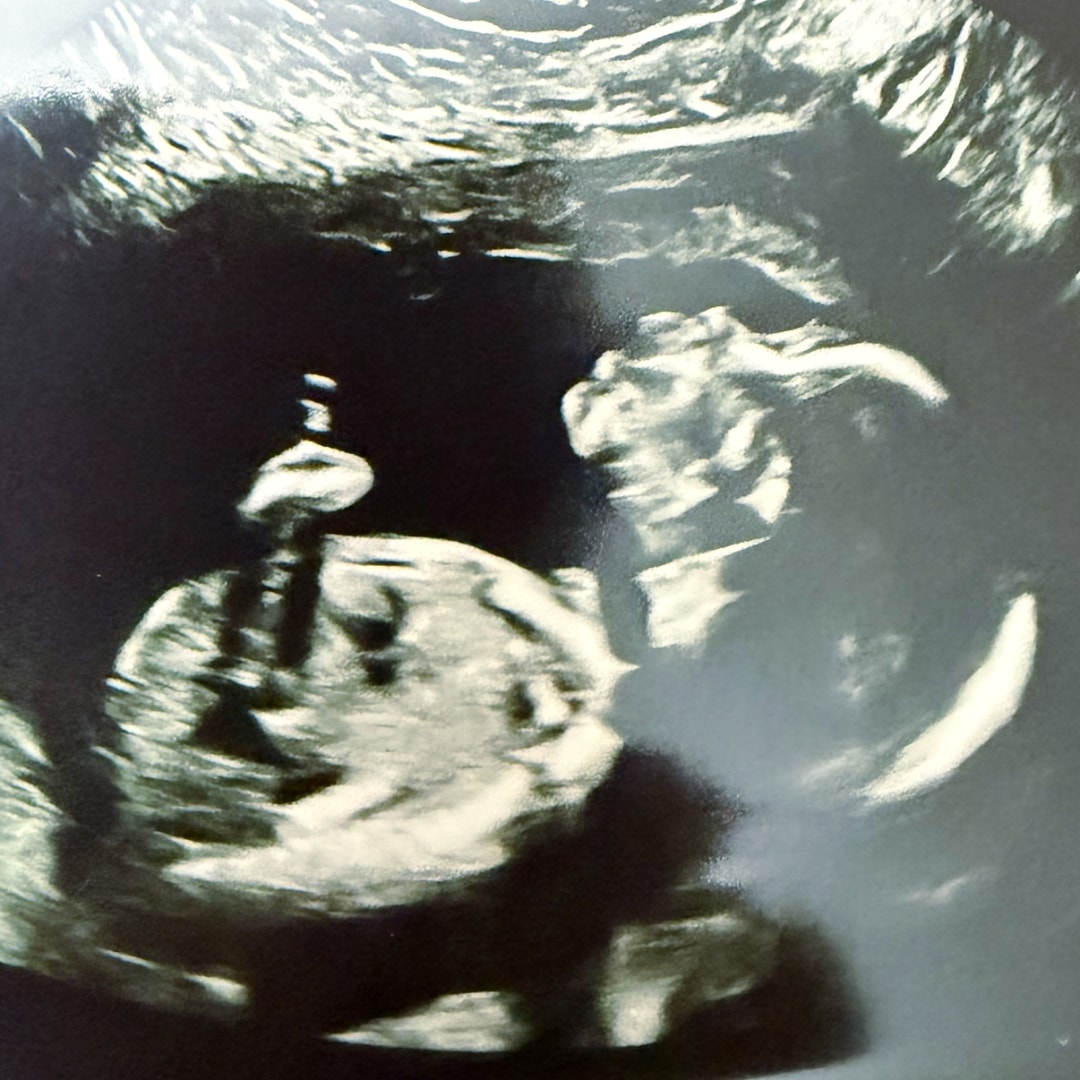 Photo shared by Joseph for their Babylist baby registry.