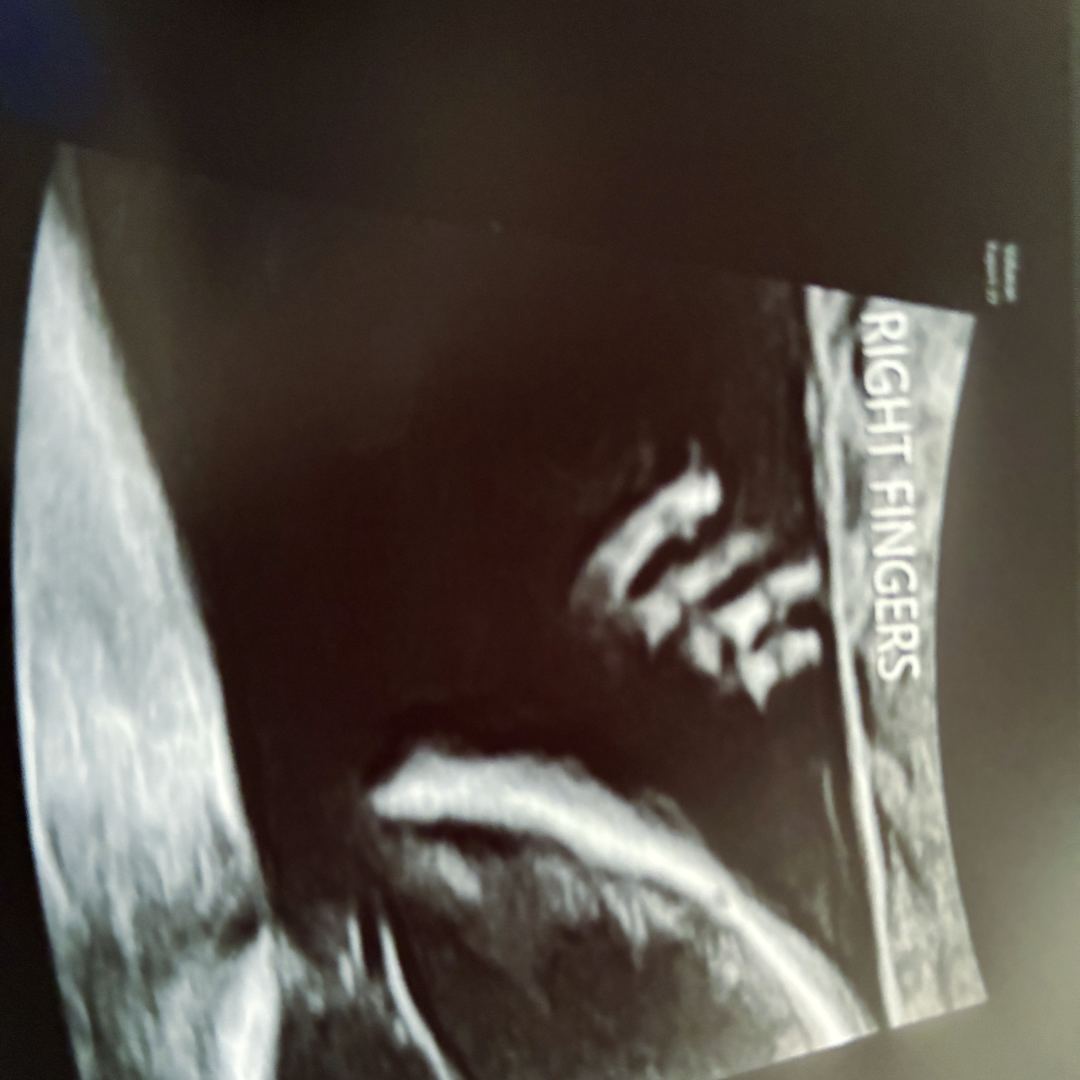 Photo shared by Ashley for their Babylist baby registry.